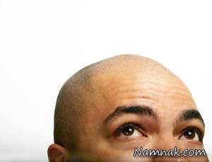 کچل ، کچل کردن