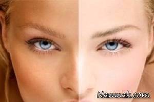 برنزه کردن ، برنزه کردن پوست
