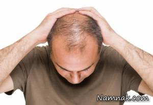 ریزش مو ، ریزش مو واگیر دار