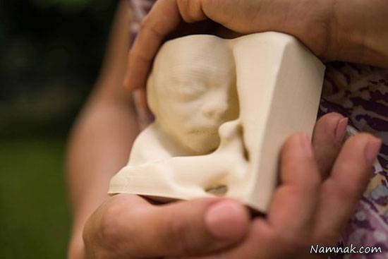  تصویر سه بعدی جنین