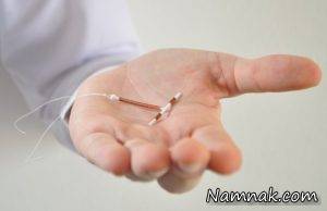 بارداری ، بارداری با IUD