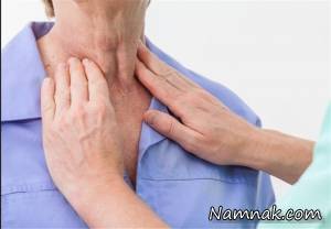 تیروئید ، کم کاری تیروئید