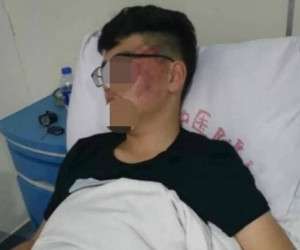 کار زشت معلم ، معلم چینی