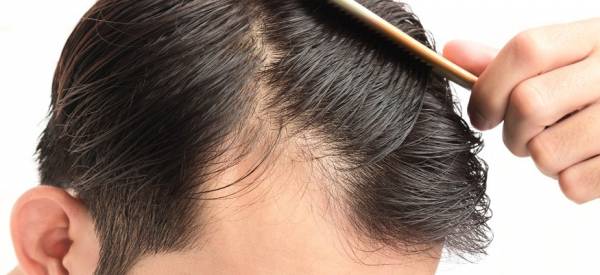 بهبود رشد مو از خواص پیاز پیاز برای رشد مو