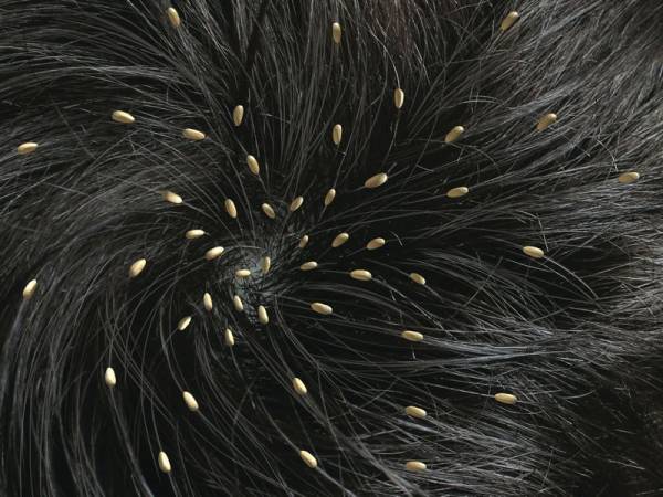 خاصیت ضد شپش پیاز پیاز ضد شپش است