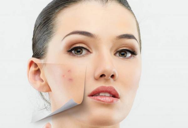 لکه های پوستی