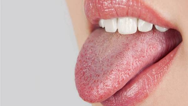 تشخیص مشکلات و بیماری ها از روی زبان تشخیص بیماری و مشکلات