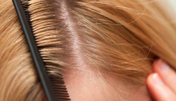 فواید سیب زمینی برای مو فواید سیب زمینی برای مو