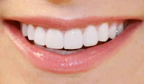داشتن دندان های سفید