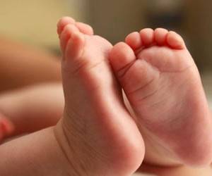 کج شدن پای نوزاد