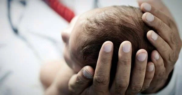 ماجرای نوزادی که در حال سنگ شدن است بیماری نوزاد