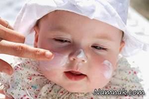 آفتاب سوختگی ، قرمزی پوست