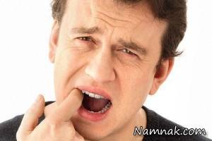 حفره خشک ، درای ساکت