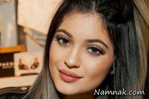 برجسته شدن لب ، لب های برجسته