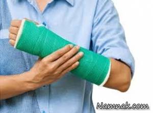 جوش خوردن استخوان ، ترمیم استخوان شکسته