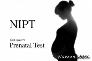 تست NIPT ، تست سلامت جنین