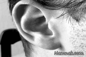لاله گوش ، وجود مو در لاله گوش