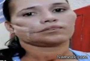 نارنجک ، نارنجک در صورت یک زن