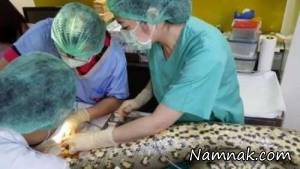 تومور قلبی ، مار آناکوندا