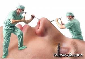 عمل زیبایی ، مراکز عمل زیبایی بینی