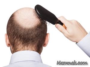 جلوگیری از ریزش مو