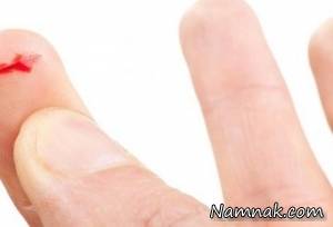 آسیب های کاغذ ، درد کاغذ