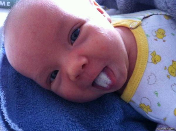 چرا لب نوزاد سفید می شود