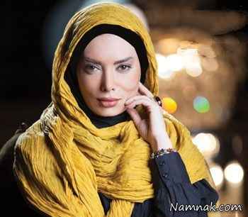 جراحی زیبایی نگار فروزنده عکس نگار فروزنده