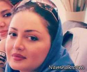 شیلا خداداد ، عمل زیبایی شیلا خداداد