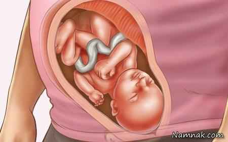 تصویر جنین 28 هفته ای ، هفته 28 بارداری ، هفته 28 حاملگی