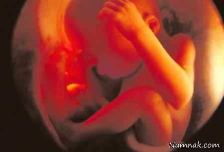 عکس جنین در رحم مادر ، حاملگی ، هفته 28 بارداری
