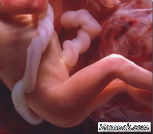 جنین در رحم مادر ، بارداری در هفته بیست و نهم ، حاملگی