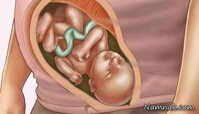 تصویر جنین در رحم مادر ، هفته سی سوم بارداری ، بارداری