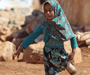 پای مصنوعی ، پای مصنوعی مایا