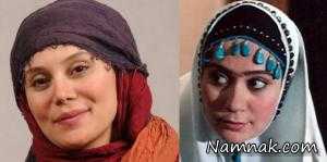 بازیگران زن ایرانی قبل و بعد از عمل زیبایی + تصاویر