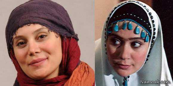 عمل زیبایی بازیگران ایرانی