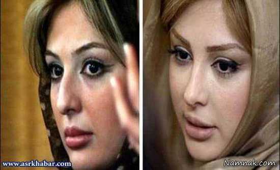 نیوشا ضیغمی ، بازیگران قبل و بعد از عمل ، بازیگران عمل کرده ایرانی