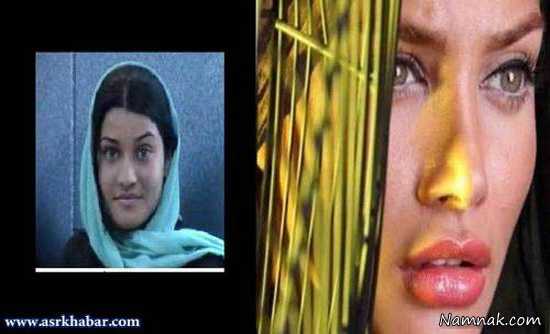 تینا آخوند تبار ، بازیگران عمل کرده ایرانی ، بازیگرانی که عمل زیبایی انجام داده اند