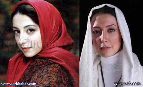 سحر جعفری جوزانی ، شیلا خداداد قبل و بعد از عمل ، بازیگران زن ایرانی قبل و بعد از عمل زیبایی