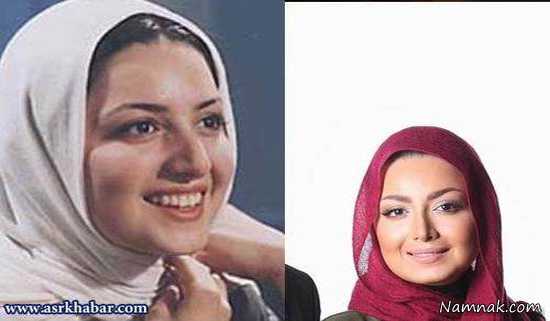 شیلا خداداد ، بازیگران زن ایرانی قبل و بعد از عمل زیبایی ، بازیگران قبل و بعد از عمل
