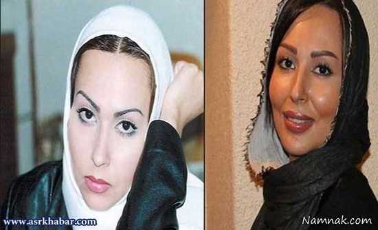  پرستو صالحی ، بازیگرانی که عمل زیبایی انجام داده اند ، بازیگران قبل و بعد از عمل