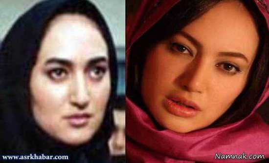   صبا کمالی ، بازیگران قبل و بعد از عمل ، بازیگران عمل کرده ایرانی