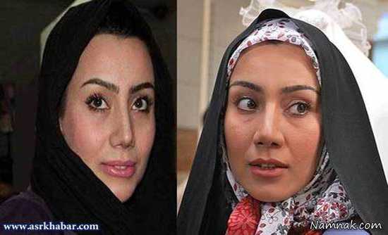  خاطره حاتمی ، بازیگران قبل و بعد از عمل ، بازیگران عمل کرده ایرانی