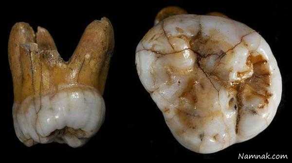 دندان 110 هزار ساله