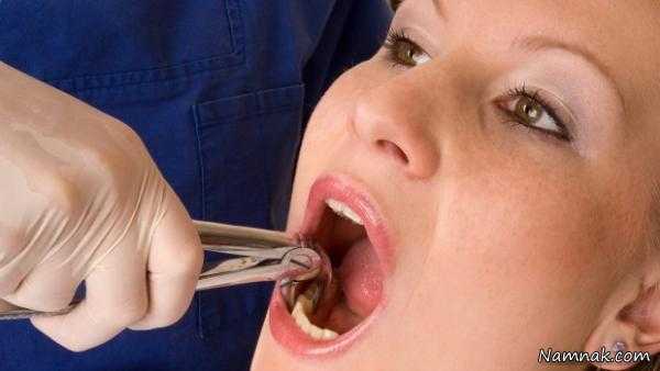 لق شدن دندان  ، ‌ دندان ، سلامت دهان و دندان