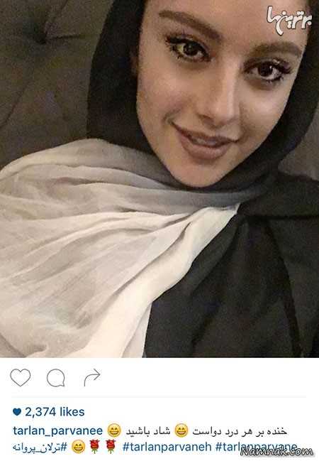 ترلان پروانه ترلان پروانه
