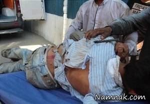 میلگرد ، فرو رفتن میلگرد در بدن کارگر