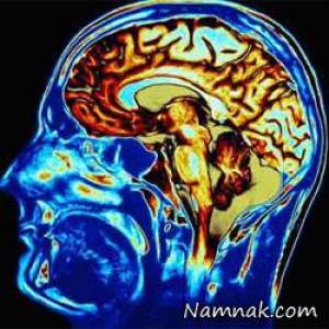 ضربه مغزی ، ضربه مغزی