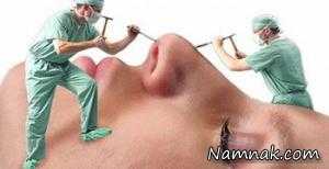 جراحی بینی ، جراحی بینی دختران ایرانی