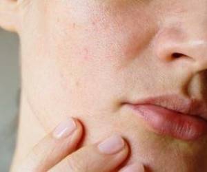 منافذ باز پوست